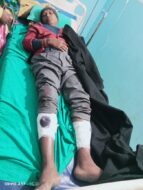 सरायकेला: अवैध वसूली को लेकर बवाल, JLKM नेता व समर्थकों ने पुलिस पर हमला