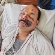 राष्ट्रीय खिलाड़ी सह कोच सुरेश नारायण चौधरी सड़क दुर्घटना में बुरी तरह घायल, टीएमएच में इलाजरत