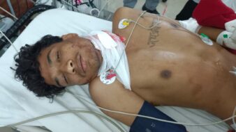 प्रेम प्रसंग में हमला: जमशेदपुर में युवक पर चापड़ से वार प्रेम प्रसंग में हमला