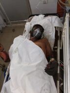 चांडिल के गैलेक्सी इंगोट प्लांट में भीषण विस्फोट, दो मजदूर गंभीर रूप से झुलसे