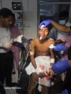 रांची मांडर थाना क्षेत्र में गुरुवार को स्कूल की छुट्टी के बाद दिल दहला देने वाली घटना सामने आई. संत जेवियर्स स्कूल मिशन के बाहर