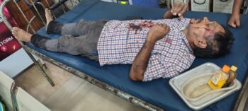 हल्दीपोखर रेलवे साइडिंग में कोयला चोरों ने निजी सुरक्षा गार्ड को किया घायल