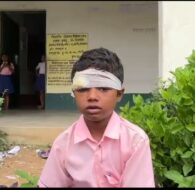 प्रधानाध्यापक पर छात्र का सिर फोड़ने का आरोप, तीन टांके लगने के बाद रुका खून
